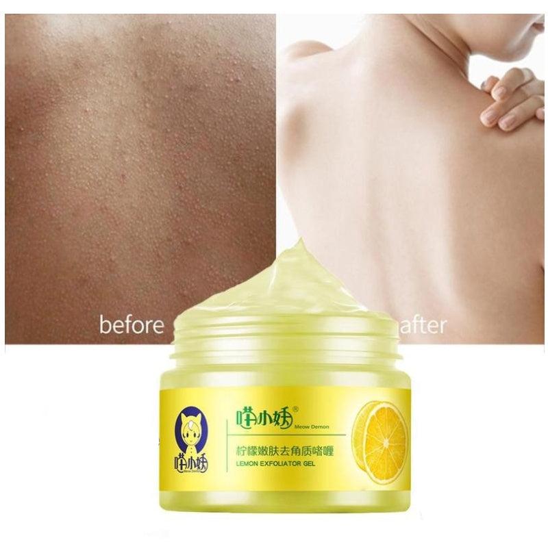 Lemon Rejuvenation Exfoliating Gel – Deep Clean Pore & Dead Skin Removal (120g) | Bentalia Home